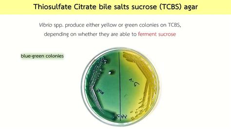 tcbs agar selective and differential